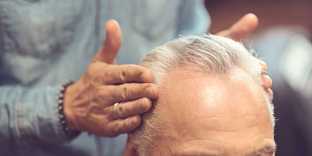 White Hair Transplant