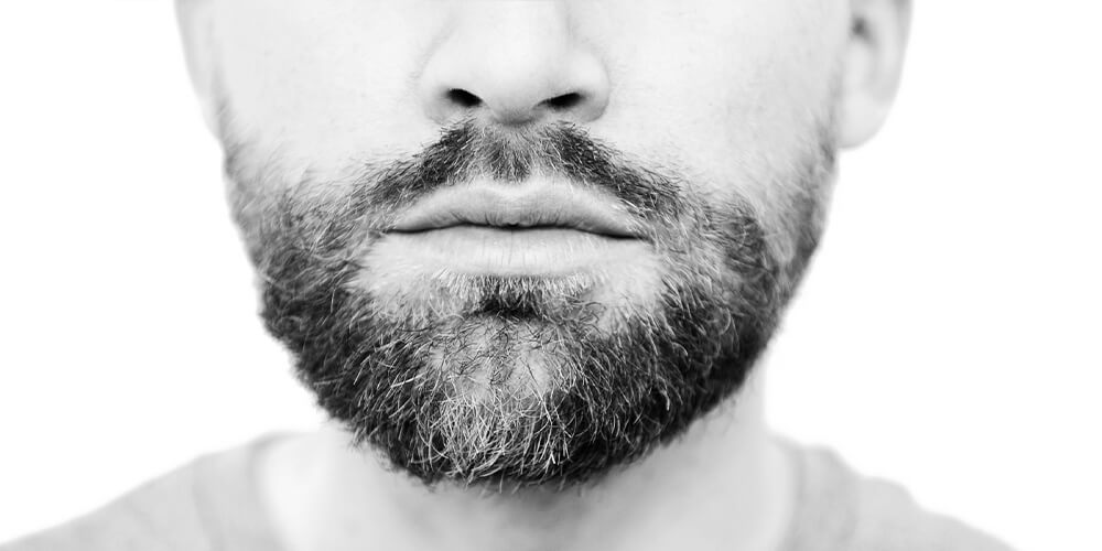 What is Beard Alopecia?