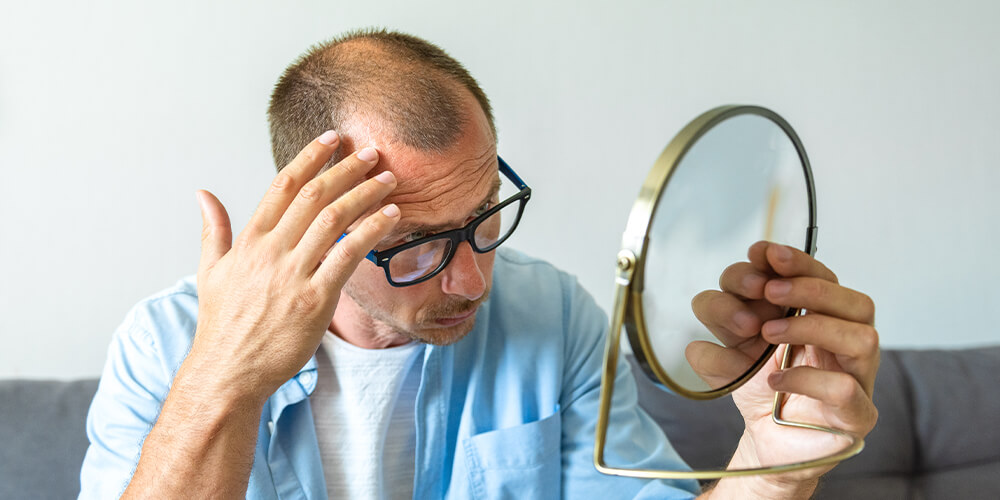 Haartransplantation auf dem Oberkopf