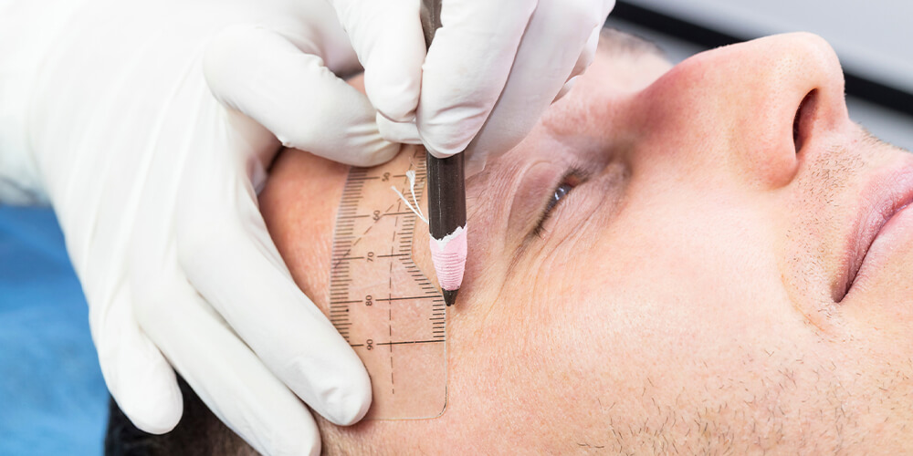 Crusting After Eyebrow Transplant