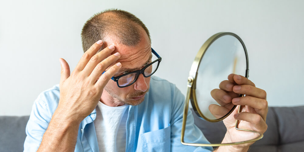 El Mejor Momento Para el Trasplante de Cabello