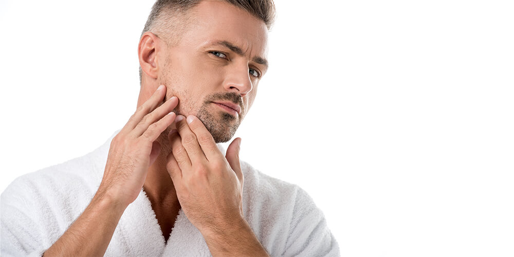 ¿Se realiza un trasplante de barba con cicatrices de quemaduras?